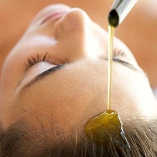 La caspa como la causa de la alopecia